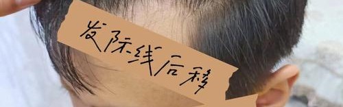 2021许个愿：我要不会掉的发际线！