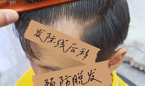 2021许个愿：我要不会掉的发际线！