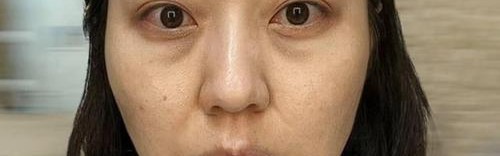 姐姐们眼周都还没有皱纹，你却先有了？