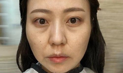 姐姐们眼周都还没有皱纹，你却先有了？