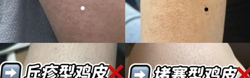 真皮包皱了怎么恢复,老母鸡油不能用热水洗最多用湿布擦一下