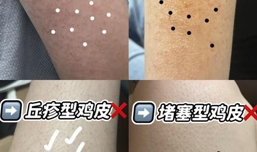 真皮包皱了怎么恢复,老母鸡油不能用热水洗最多用湿布擦一下