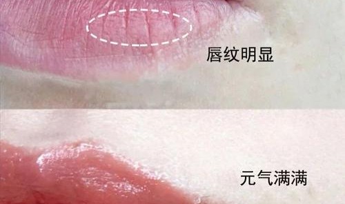 唇部护理很重要，女明星的秘诀在这里！