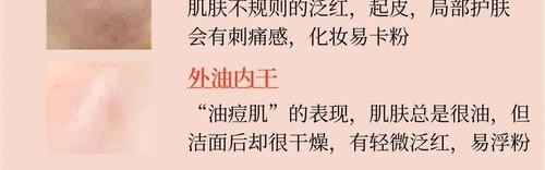 一不小心就烂脸，你确定要跟风给肌肤下猛药？