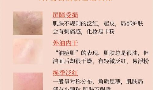 一不小心就烂脸，你确定要跟风给肌肤下猛药？