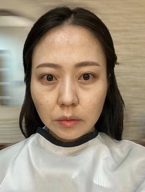 姐姐们眼周都还没有皱纹，你却先有了？