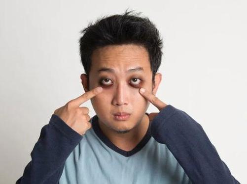 有黑眼圈的我,是真的累