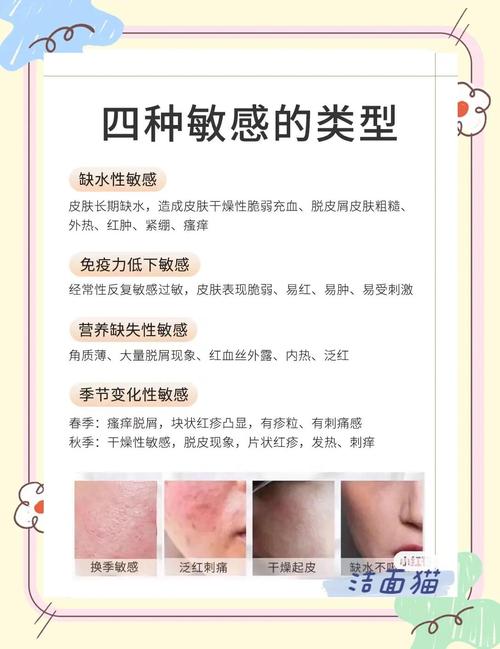 四种肤质洁面大招,这么多年你的脸都洗对了吗?