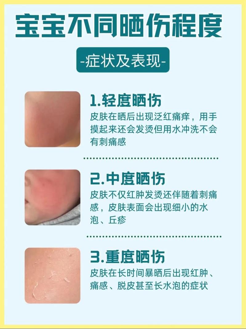 炎炎夏日脸部身体急需“灭火”,这些清爽单品都是你的菜!