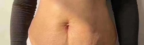 生娃之后肌肤松弛显老？看了她们之后觉得并没有啊！