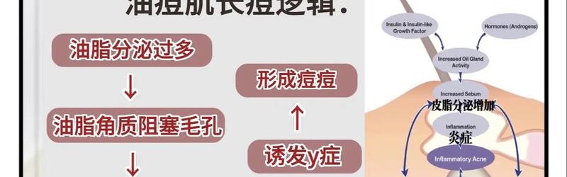 安抚油痘肌&干敏皮，肌肤也要断舍离！
