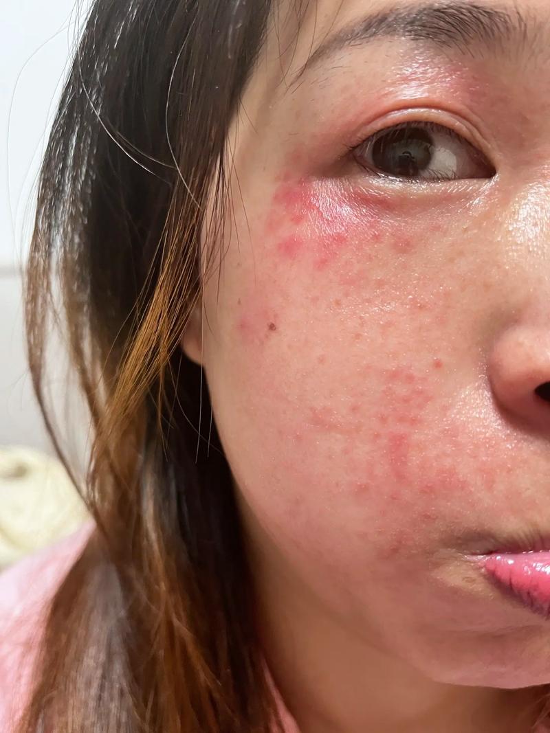 干燥、敏感、爆痘这些换季期老大难问题,就这么轻松解决了?