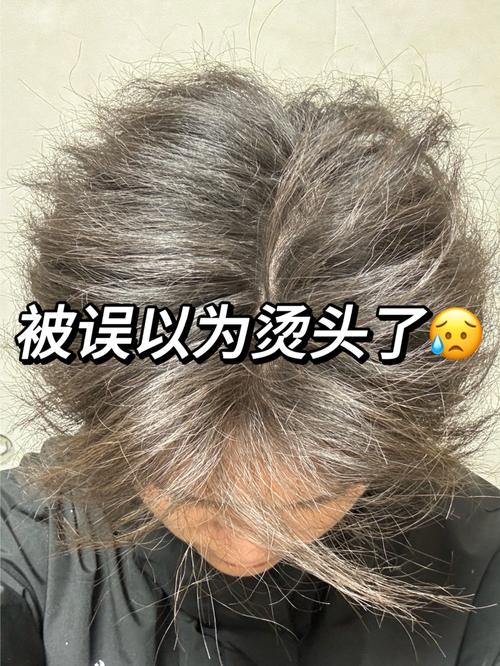 废柴头发这样养护还能救?
