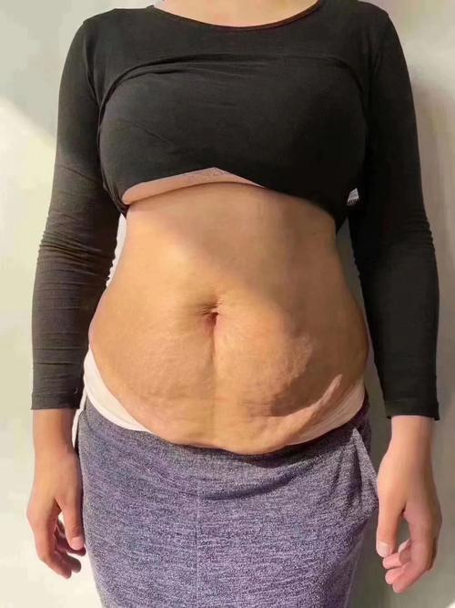 生娃之后肌肤松弛显老?看了她们之后觉得并没有啊!