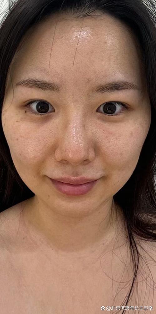 生娃之后肌肤松弛显老?看了她们之后觉得并没有啊!